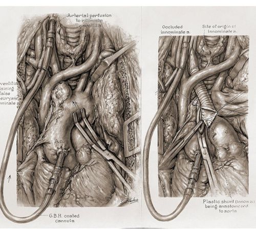 #throwbackthursdays Incredible carbon dust illustrations from Leon Schlossberg. Leon had a long and 