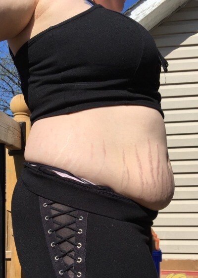 mychubbyqueen:  Bout a year ago up till now. Tease her for being such a fat piggy 🐷 