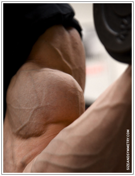  Igorem Illésem  google maps should use his veins instead