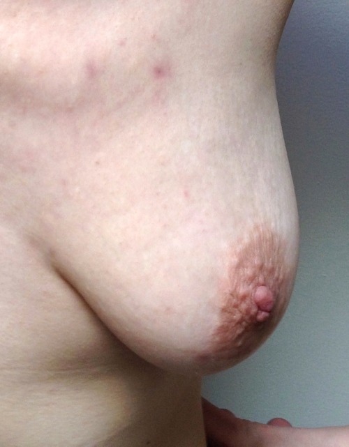 Stretchmarked Tits & Nipples