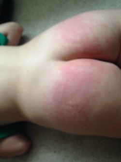 sosicks-babygirl:  Daddy spanked me really hard this morning😍😍