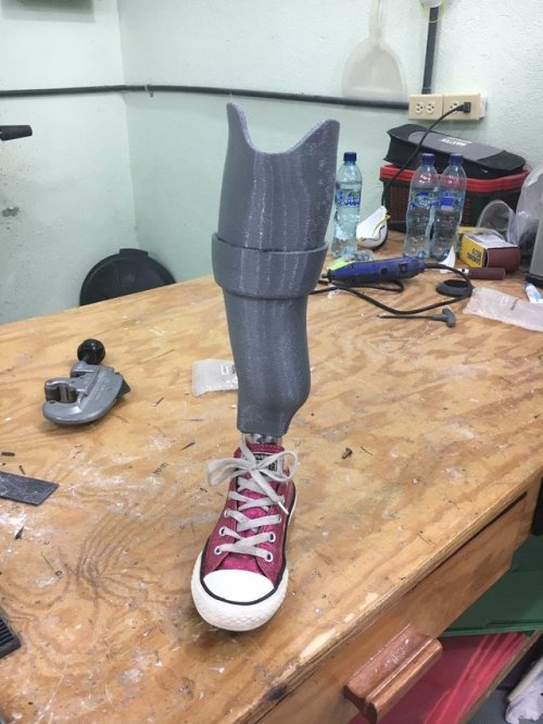 Purple converse sneaker on the prosthetic leg