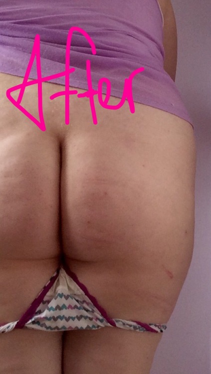 shamelessprincess:  Wonderful weekend with daddy shamelessdaddydom 💖 but even after a quick lesson from brat-grrrrl, and a intense beating from daddy, I still remain unbruised 😍 my bottom is magical 💕