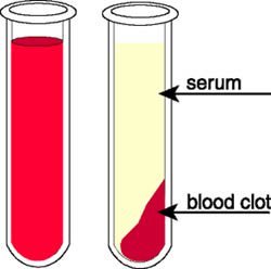 BIOCHEMISTRY BLOOD TESTINGBiochemistry blood test measures the levels of chemical substances carried