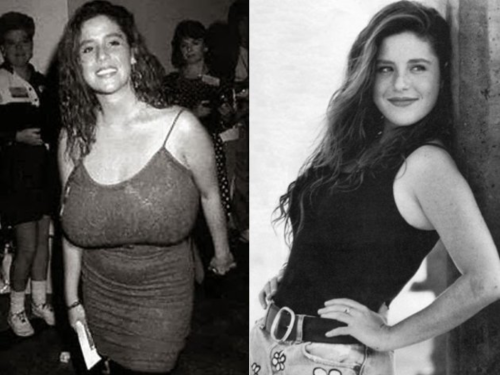 One of America&rsquo;s worse breast mutilations. When Punky Brewster got a breast reduction. That le