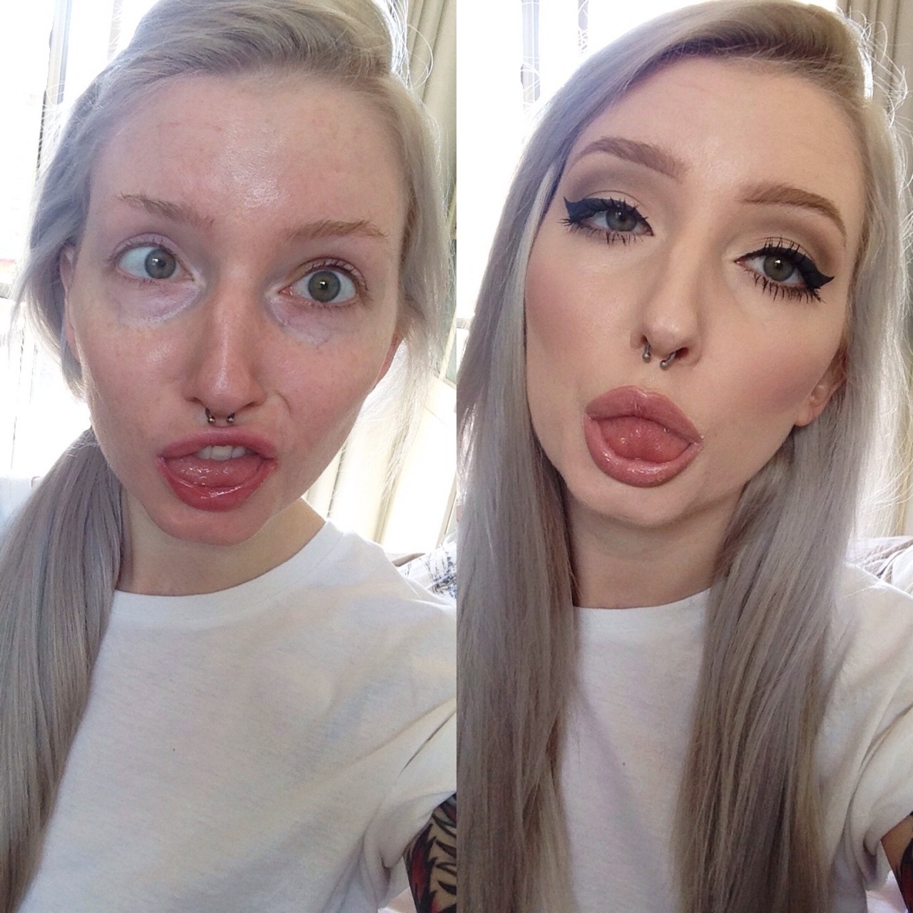 kimberryberry:  Shame I can’t fix my face with makeup :’(