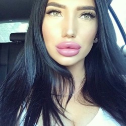 8im80c1u8:                      Lip Filler adult photos