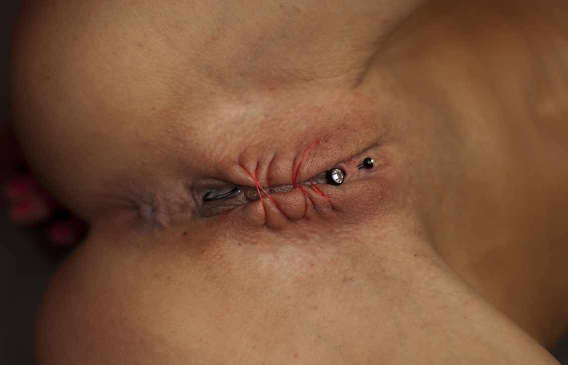 painsain:Pussy sewn shut.