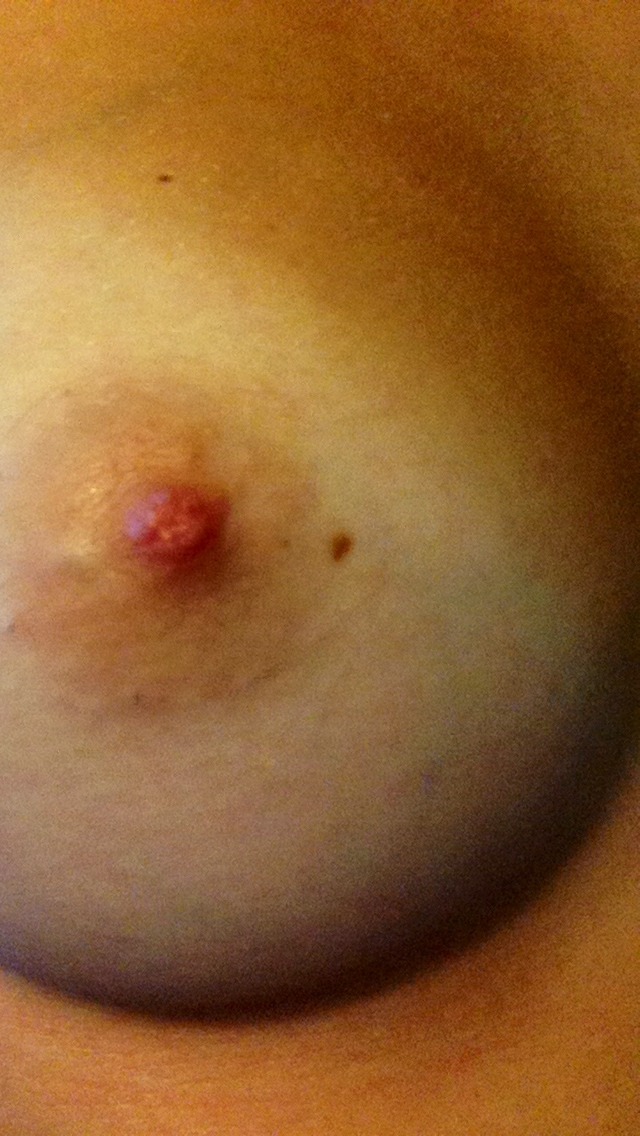 your-classy-slut:  I love my nipple freckle so much.  I’ve had it since I was born