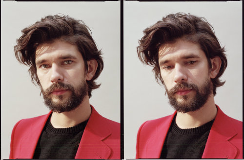 simonwolfgard:“I have a lot of fear,” Mr. Whishaw said. “All the time. But it&rsqu