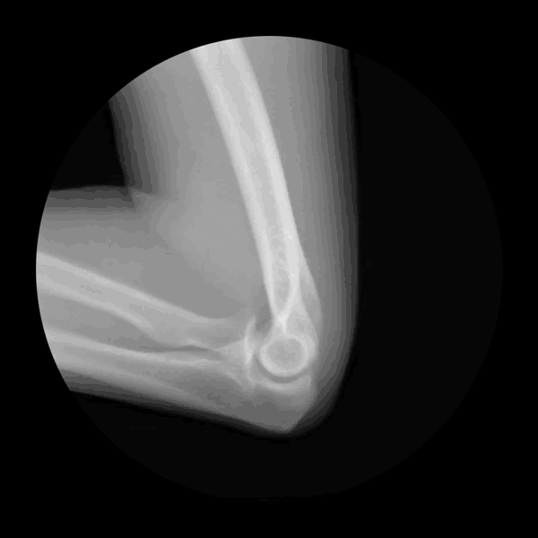 bluecaptions:  X-ray GIFs showing joints in motion.