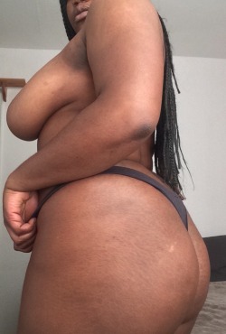 brownsunn:  Human body comes with stretch marks, birthmarks, scars and flaws🌹- |like and reblog my loves| 
