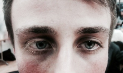 darkskie-s:  This is my friend Connal. He has Russel Silver Syndrome; due to this, his eyelashes on his right eye are blonde, and his eyelashes on his left eye are black. And I think it’s beautiful. 