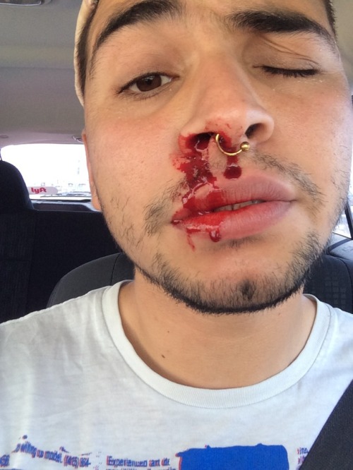 brujoria:  brujoria:  I was betrayed  I sneezed I didn’t get beat up lol