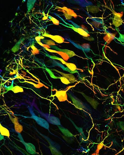 “Within the in-between” reveals brain cells and their complex interwoven processes. To c