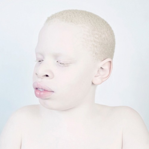 oau: Snow White by Sanne de Wilde &ldquo;Like photographic material, people with albinism are li