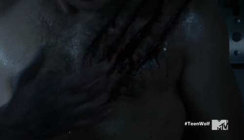 auscap:Dylan Sprayberry - Teen Wolf