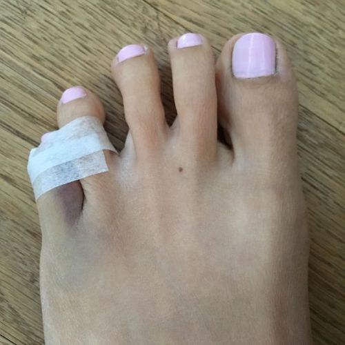 Considering if breaking toes count as a hobby as well….