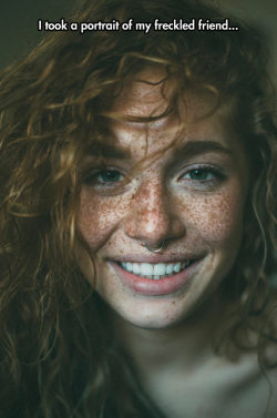 srsfunny:  Beautiful Freckleshttp://srsfunny.tumblr.com/