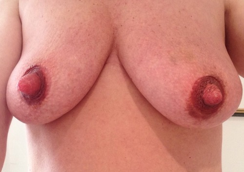 megagap:  misspissypants:  Task: Pumping Session 4 Results, feels soooo nice!  They sucked a pair of nuts out of her pussy:-)