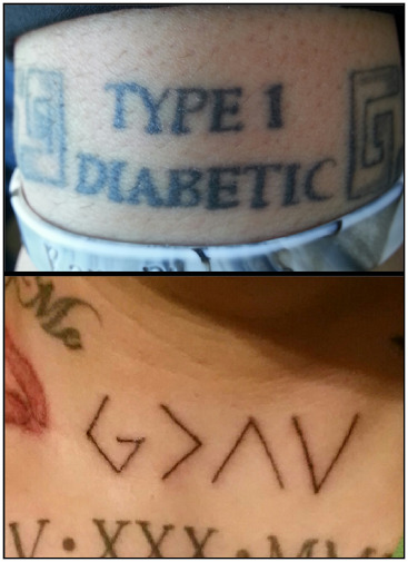 Ben’s diabetic ink
“I’ve had type 1 diabetes for 17 years. I was diagnosed at the age of 17. The doctors said that when I first went into the hospital they don’t know how I was walking because my bgl was almost 800.
One of my tattoos is a bracelet...