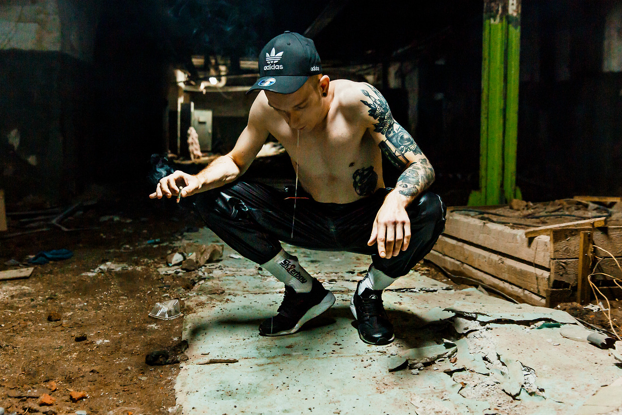 SCALLY BOY