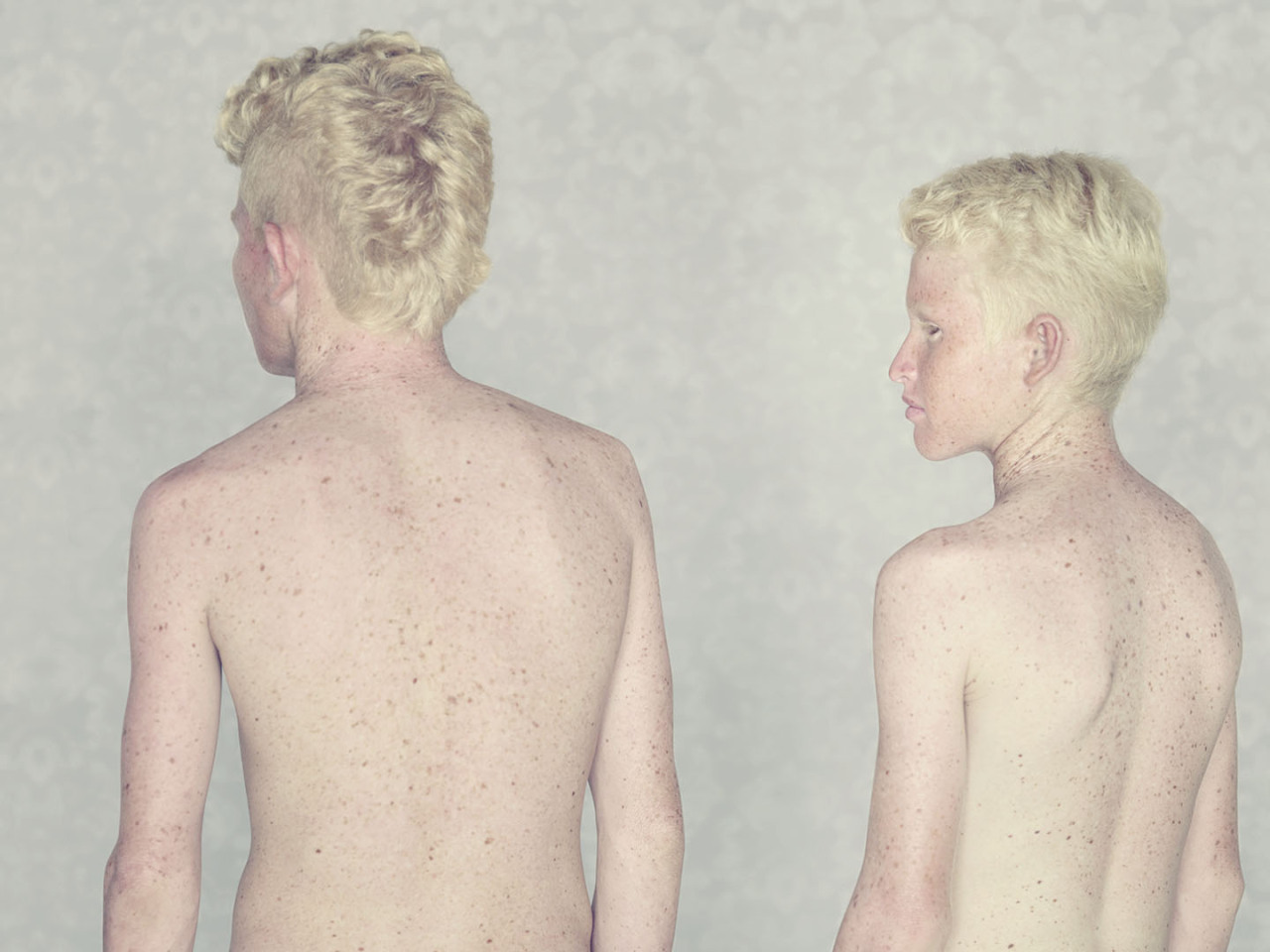 beskt:  Gustavo Larcerda - Albinos ‘’What I wanted was to give prominence to