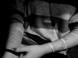 depresiondeadolescentes:  El pasado siempre estará marcado en mi cuerpo. 