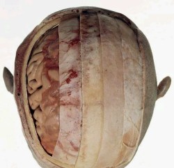 medicine-nerd:  the-med-girl:  (From right to left): Scalp, Periosteum, Bone, Dura Mater Arachnoid Mater, Pia Mater, Brain.* From right to left: skin, galea aponeurotica (connecting the two parts of Musculus occipitofrontalis, periost, bone, dura mater,