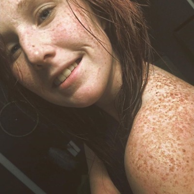 Naked Freckles Tumblr