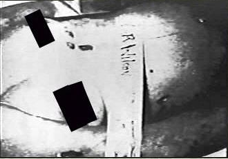sharon tate autopsy ohotos sharon tate autopsy ohotos