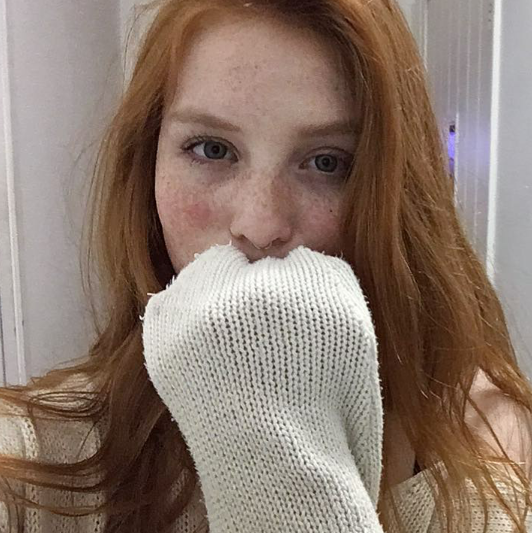 yesgingerfriend:  gewelmaker:Samantha Heck Müller Tolle Sommersprossen