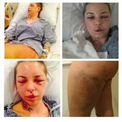 cutebabe:  creepy-spice:  Sorry to interrupt the Robin Williams posts but I feel like this needs to be shared. The adult film star Christy Mack has been hospitalized after being severely beaten by former boyfriend/MMA Fighter, Jonathan Koppenhaver aka