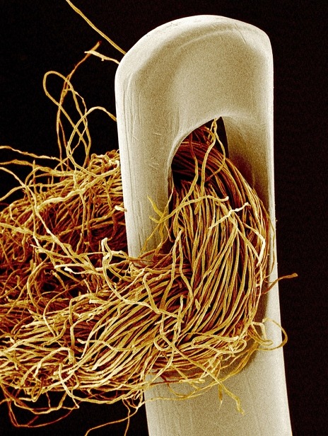 samsaranmusing:  Scanning electron microscope photos:  Needle and Thread Salt and Pepper Velcro 