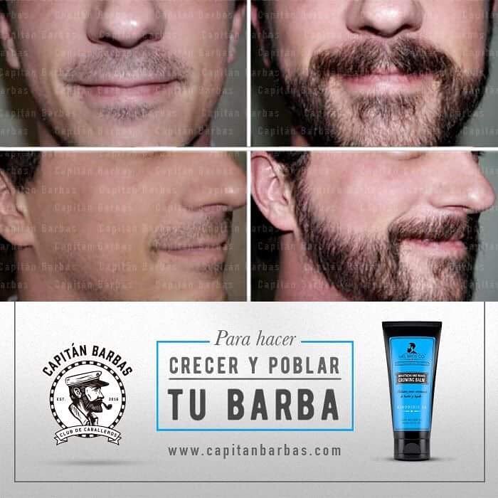 Empieza a tupir y completar tu barba con este poderoso tratamiento con  minoxidil y otros ingredientes que no resecan el rostro. –  @capitanbarbas on Tumblr