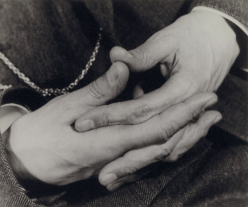 disease:  “DR. PARKES WEBER, HÄNDE”LUCIA MOHOLY // circa 1933[gelatin silver print | 10 x 12″]