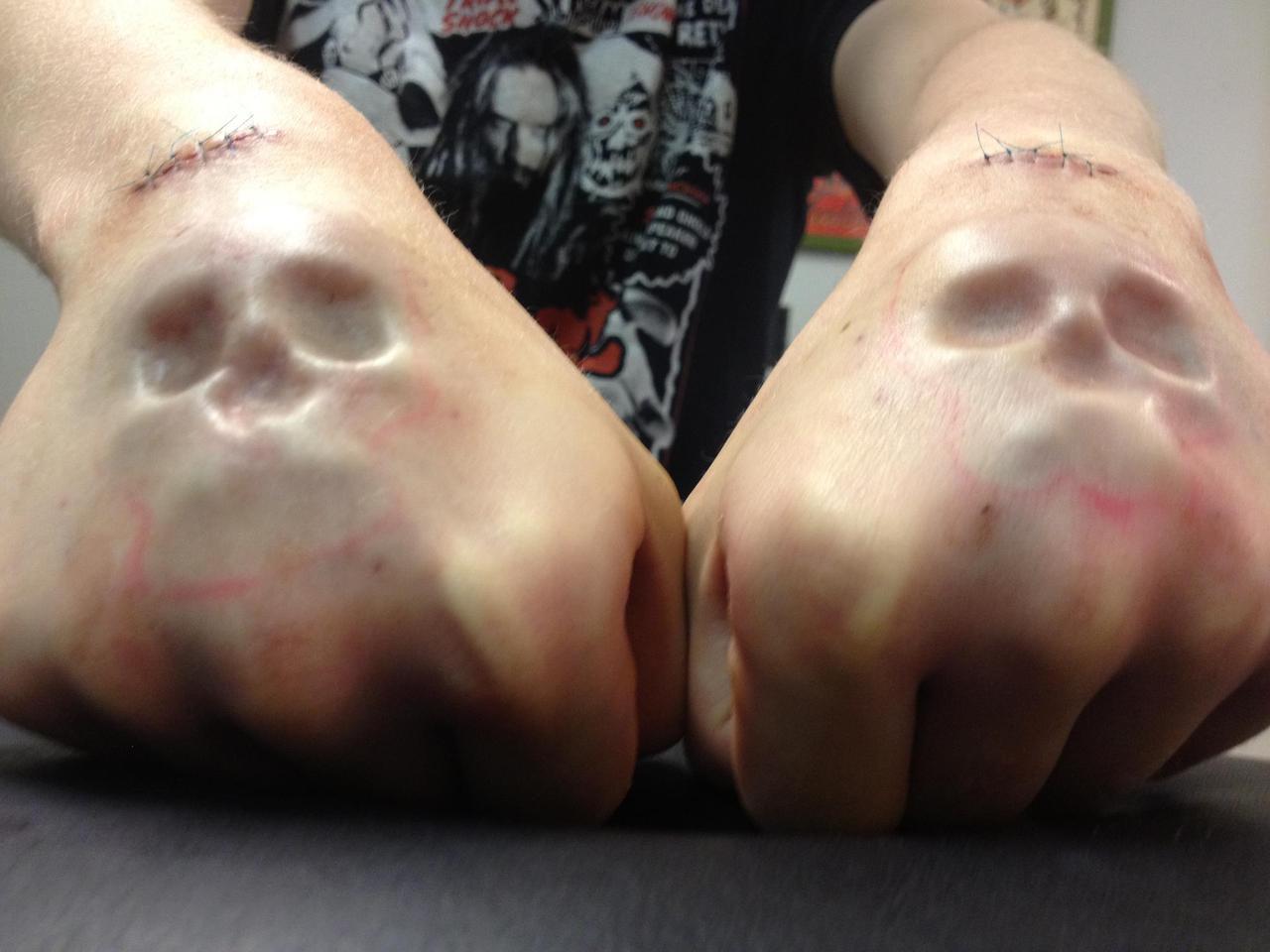 sixpenceee:  Subdermal ImplantOriginating in 1994, subdermal implant is a method