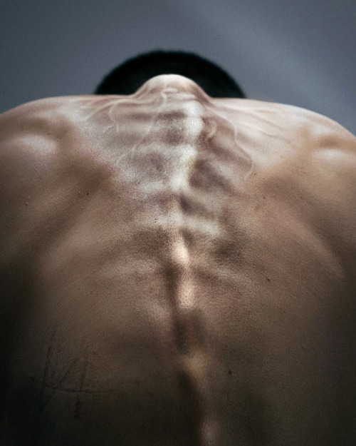 A photograph of a person's back. Their spine appears to be squirming like it has a life of its own. Near the neck, there is a large bulge where several strands are coming out, drawing root-like shapes beneath the skin.