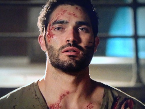 Whump Episodes and Movies — whumpsadaisy: Derek Hale, Teen Wolf, as...