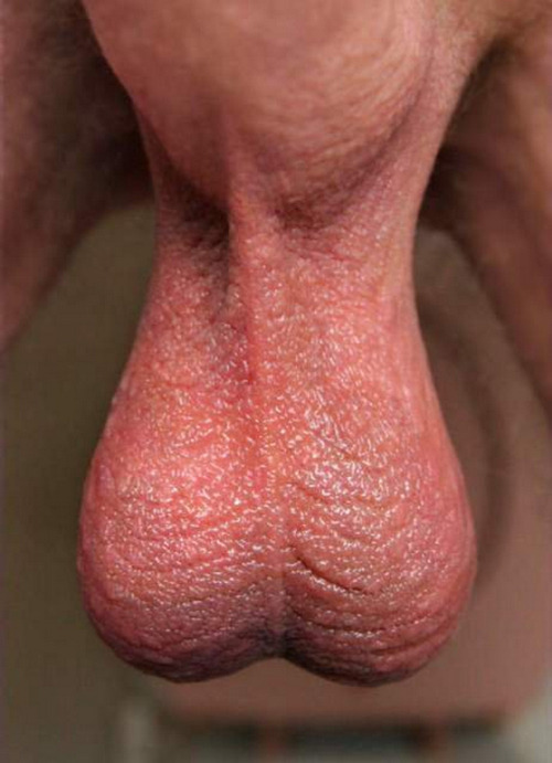 YUMMY&hellip;