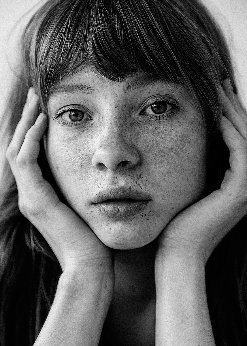 vovaklever:Freckles is beauty. Follow my instagram: https://www.instagram.com/qlevr/