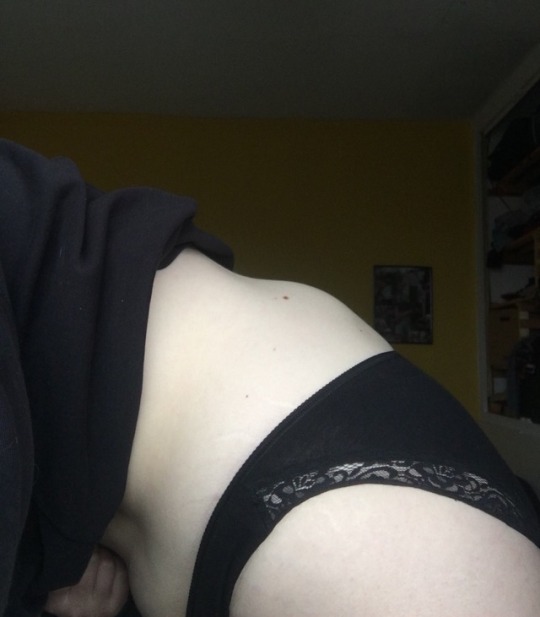 theproductofdesire:  Wanna see something gross????? Too late here’s a lump growing on my spine (Dw it’s not cancerous and I am having treatment from a hospital) 