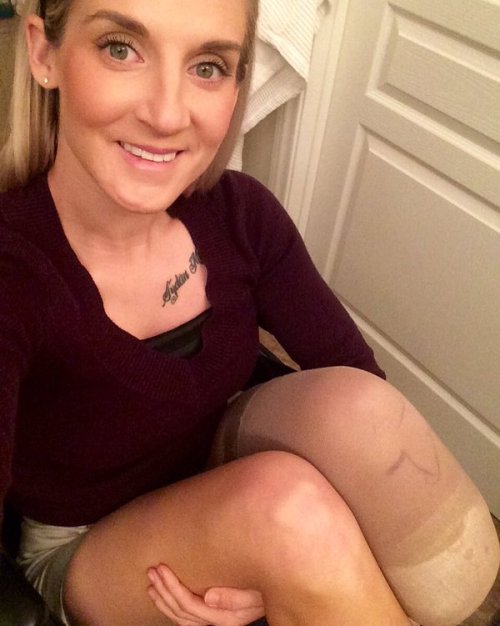 dreamputees: phelddagrif: Marine Kirstie Ennis who had her damaged left leg amputated below the knee