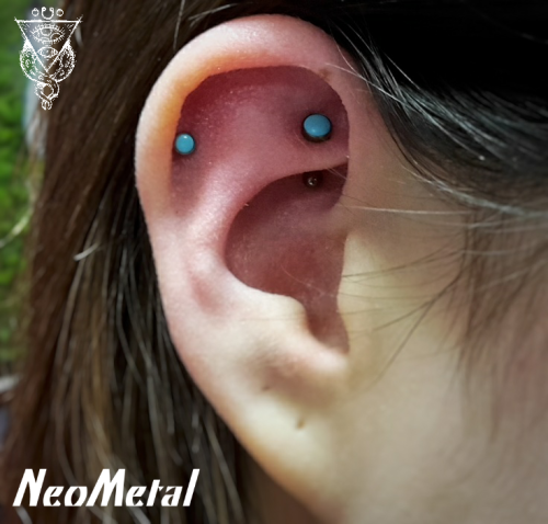 Fresh conch & two week old helix piercing with neometal turquoise caps