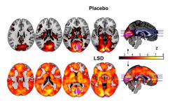 mapsnews:  LSD’s Impact on the Brain Revealed