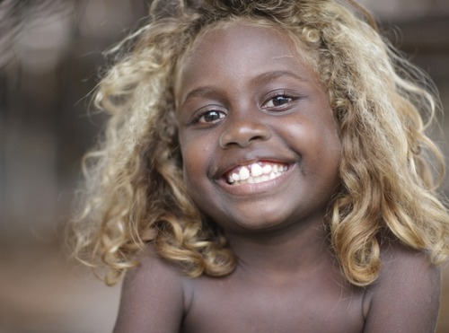 divineblu: About 5–10% of people from Melanesia, a group of islands northeast of Australia, ha