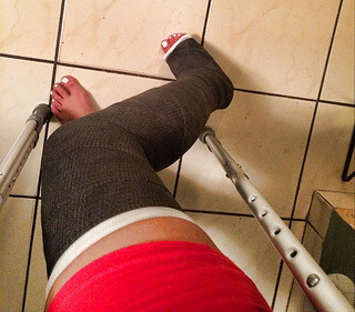 alexia17fan:long black leg cast and white painted nails!! in a cast for 8 weeks….so Humbling