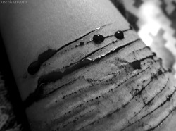 arsenic-creature:  arm.i’m sorry if triggering.