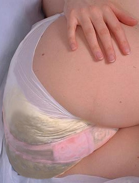 versohlter-pampespopo:erikbine:diapergilrs:messy diaper girls!!(viaTumbleOn)Nice poop Diaper