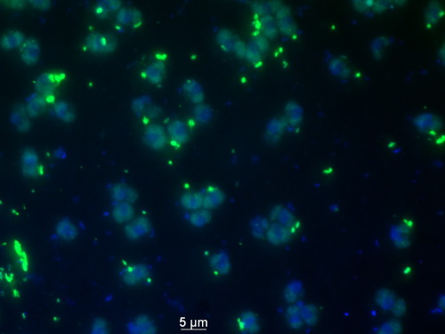 Infected bacteria (green) and uninfected bacteria (blue) spread throughout phytoplankton in the ocea